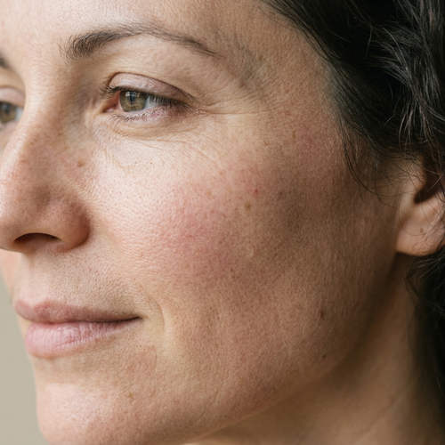 Melóvia — calm, comfortable-looking skin